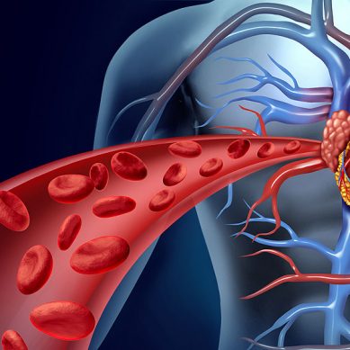 Procedure chirurgiche in pazienti in terapia anticoagulante e/o antiaggregante, documento di consenso