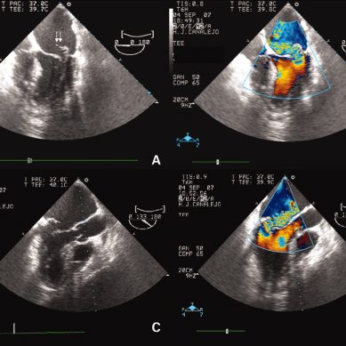 Ecocardio-ecocolor doppler: il TAR conferma la doppia prescrivibilità nella stessa ricetta