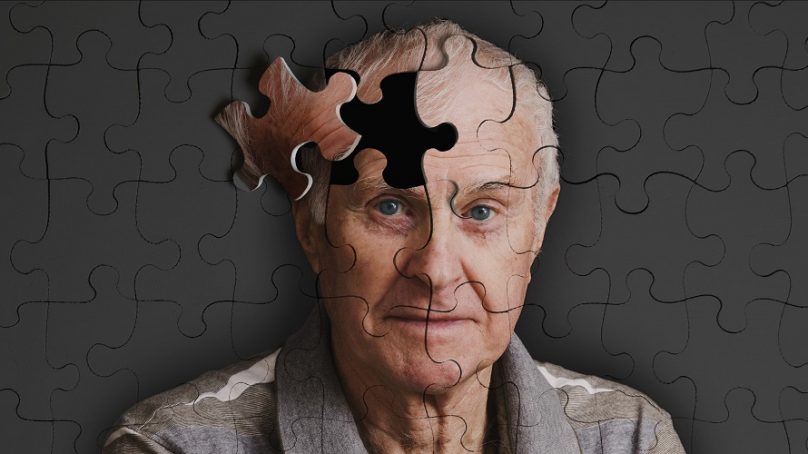 Australia: avviata sperimentazione farmaco che blocca l’Alzheimer