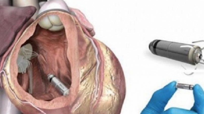 Ragusa: impiantato pacemaker di ultima generazione