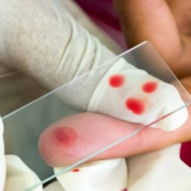 Nuove segnalazioni di malaria in Europa