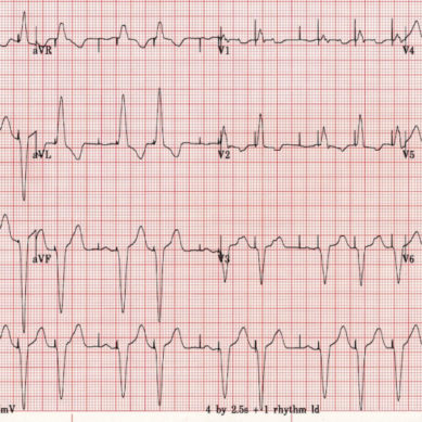 Corso di ECG il 13 Ottobre alla Fondazione Ordine dei Medici