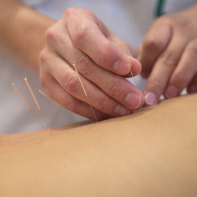 L’Agopuntura per il dolore inserita nel Sistema Nazionale Linee Guida dell’Istituto Superiore di Sanità