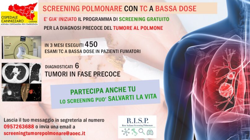 Screening polmonare gratuito all’Ospedale Cannizzaro di Catania 
