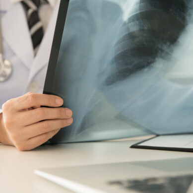 Polmoniti: un incremento allarmante