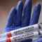 Infezioni da Hantavirus Andes (ANDV)
