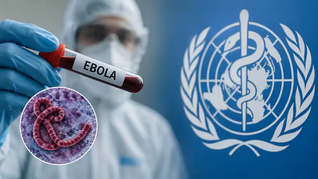 Ebola: una epidemia “lontana”?