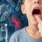 La difterite ritorna nei soggetti non vaccinati