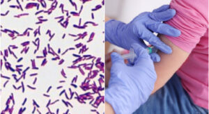 La difterite ritorna nei soggetti non vaccinati